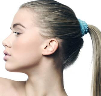 Alopecia por Tracción